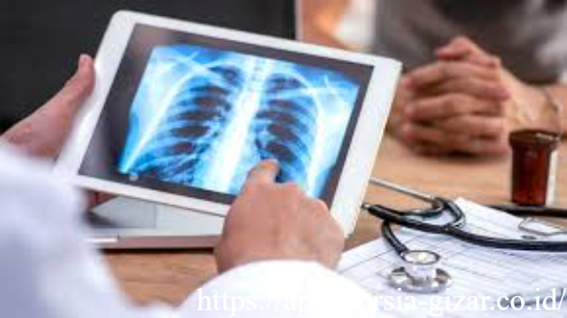 Kapan Harus CT Scan Paru? Panduan Skrining Kanker Paru